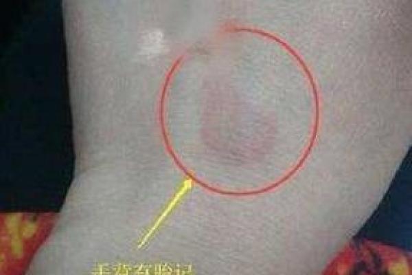 手上胎记算命图解