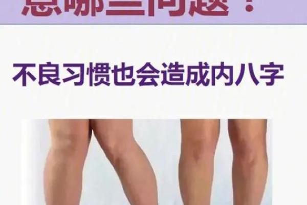 内八字腿型