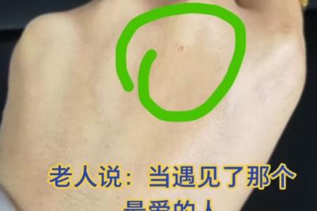 朱砂痣算命图解
